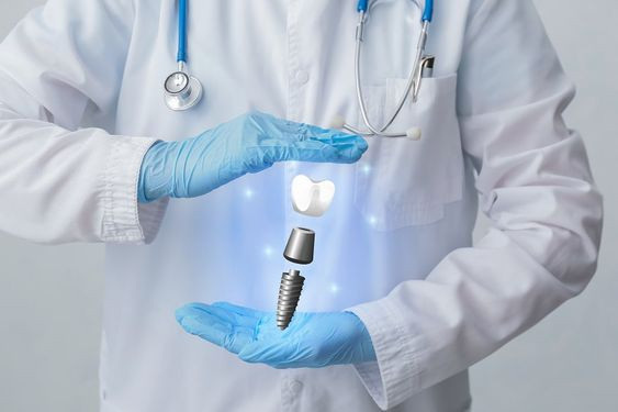 Cấy ghép Implant - Bí quyết lựa chọn phòng khám uy tín
